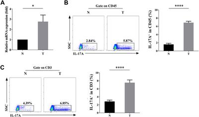 Distribution and Clinical Significance of IL-17A in Tumor-Infiltrating Lymphocytes of Non-Small Cell Lung Cancer Patients